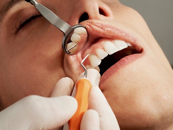 Orthodontics After Treatment
